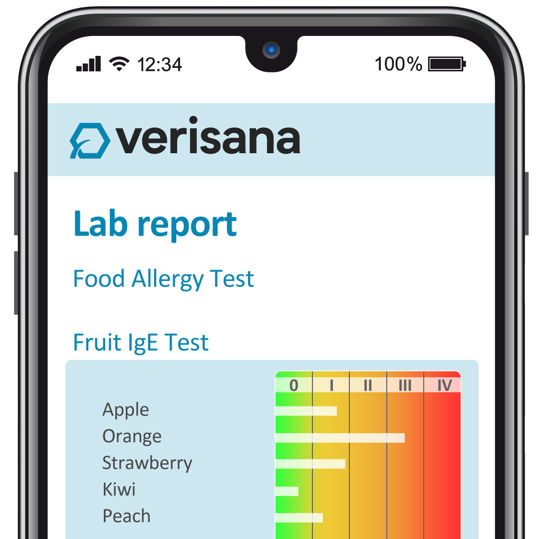 Food Allergy Test