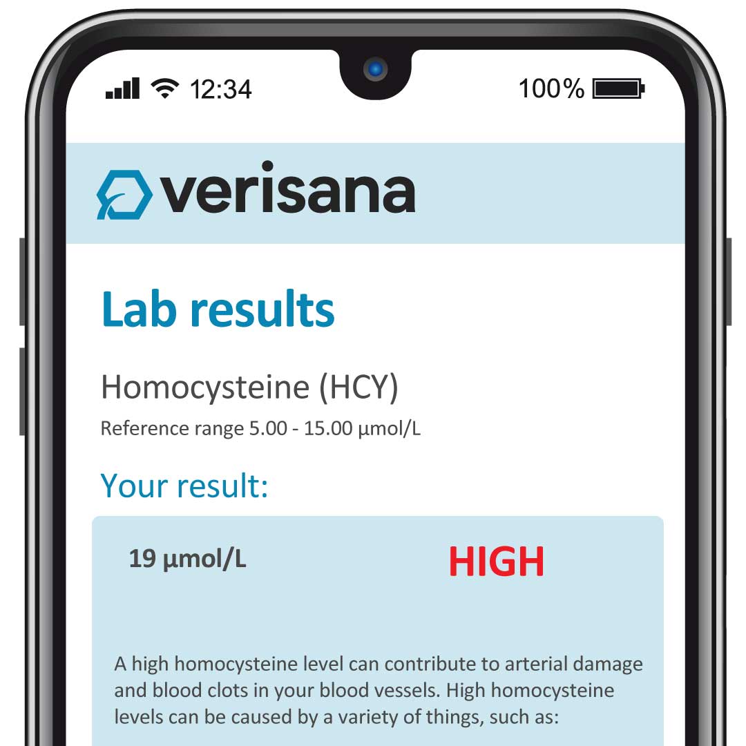 Homocysteine
